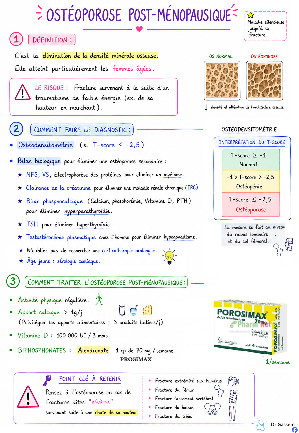 Ostéoporose post ménopause
